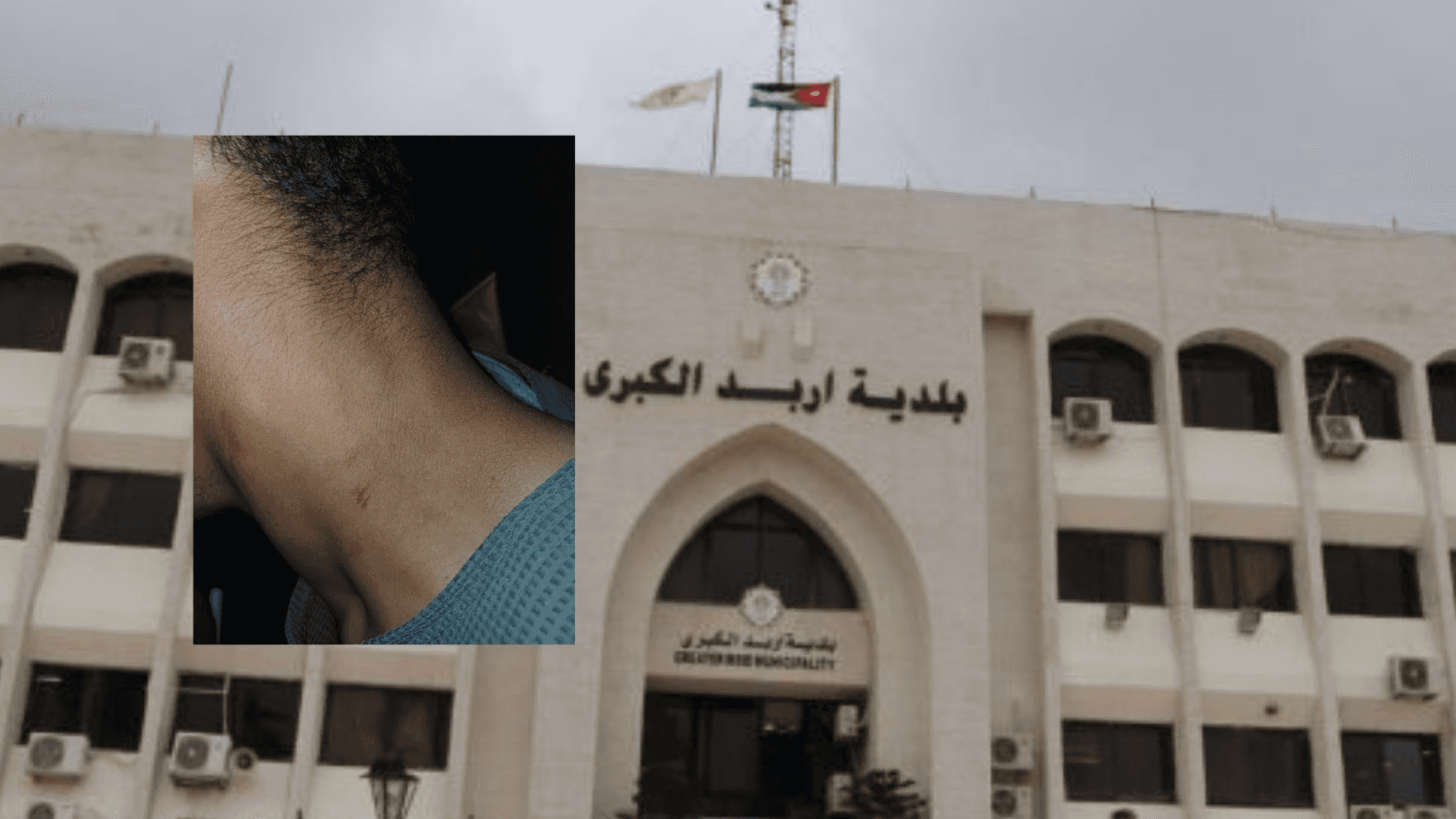 الدار -  دانت بلدية إربد الكبرى بأشد العبارات الاعتداء الذي تعرض له أح