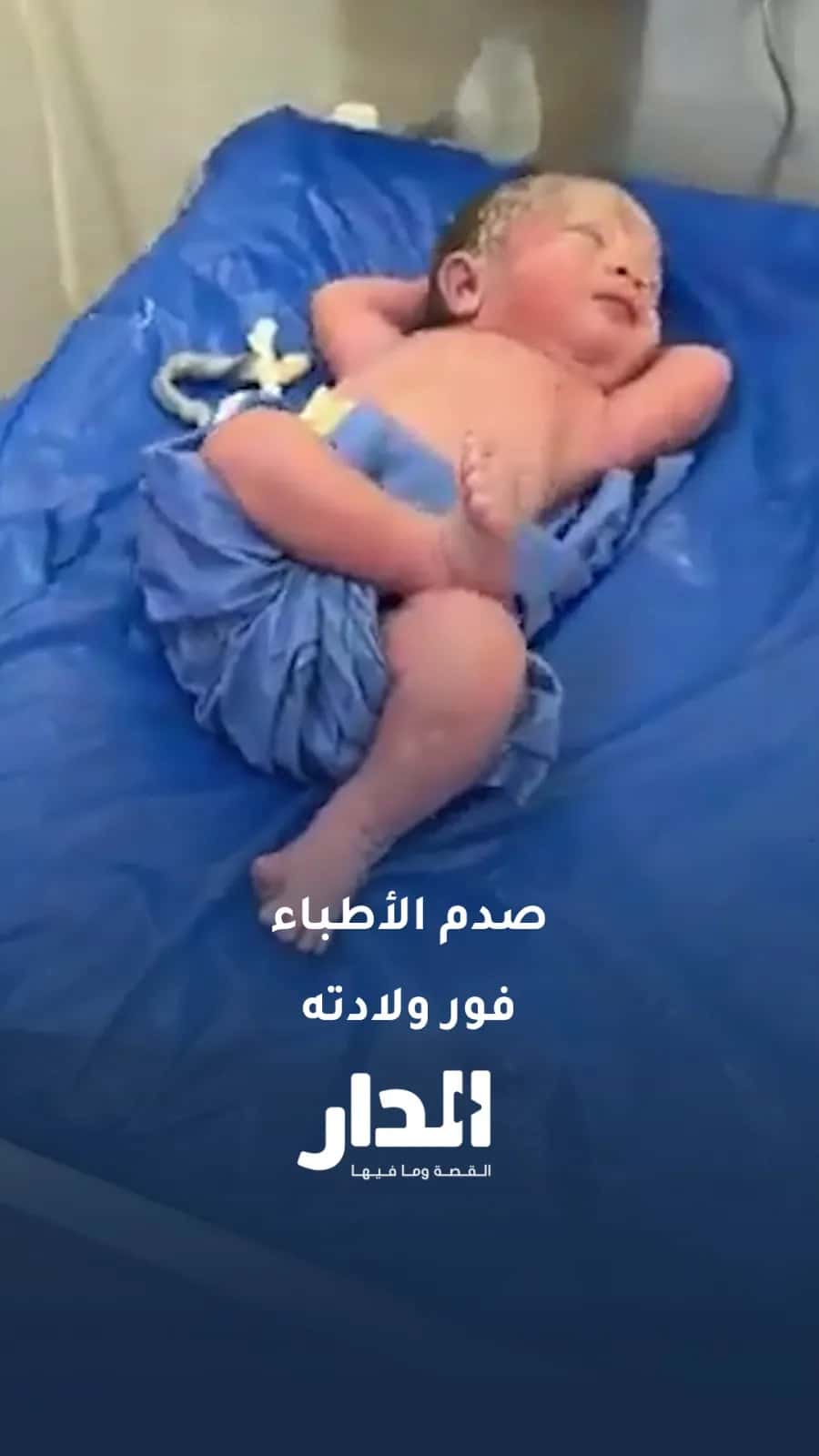 لقطة عفوية صوّرها طبيب مصري وتصدرت التريند!