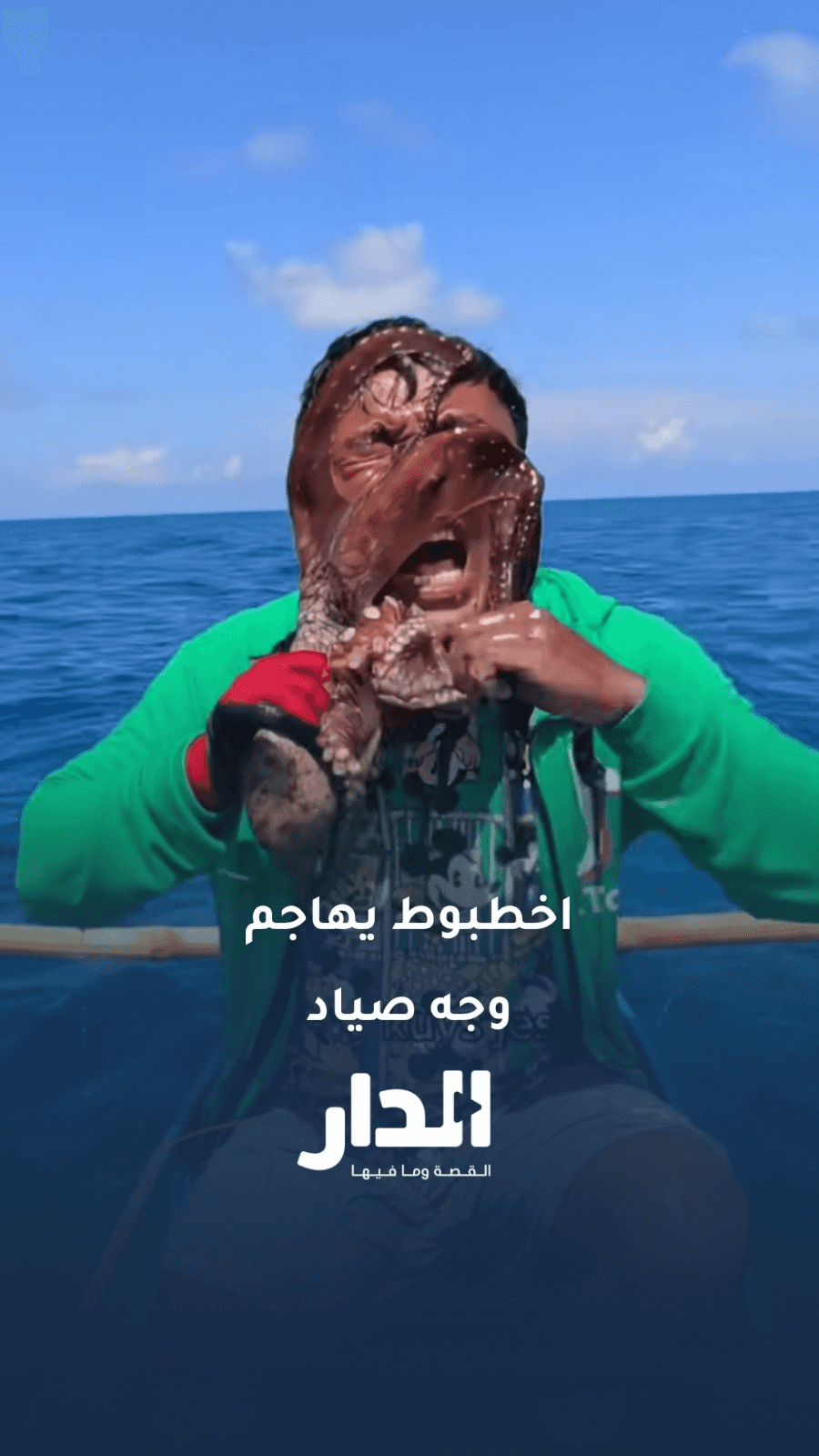 حقيقة الصياد الفلبيني والأخطبوط الملتصق بوجهه