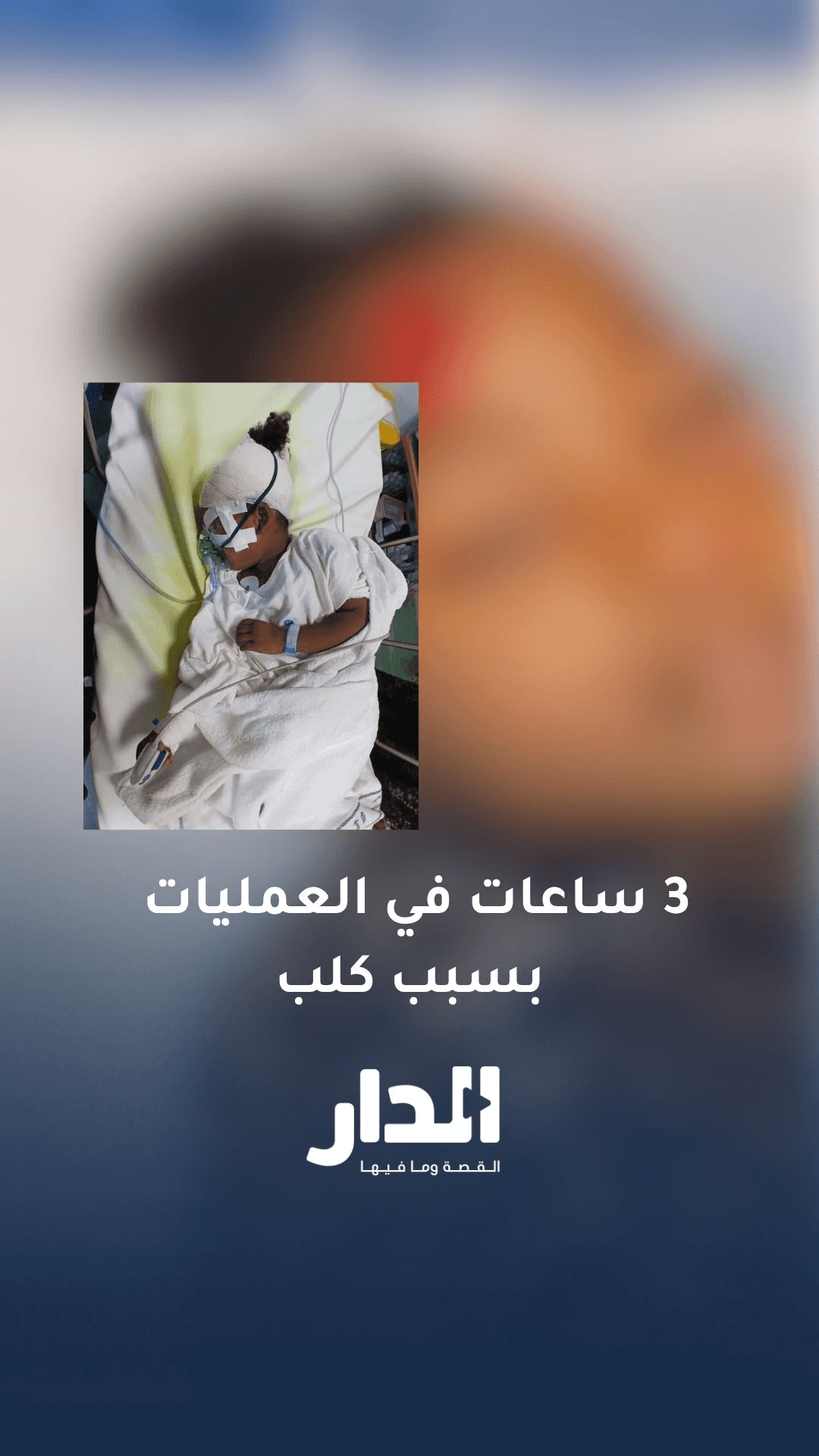 تفاصيل تعرض رهف الدغيمات لعقر كلب في غور الصافي