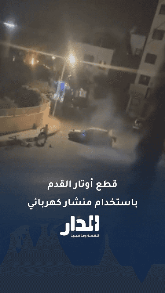 باستخدام منشار كهربائي.. الاعتداء على شخص وقطع أوتار قدمه في القويسمة