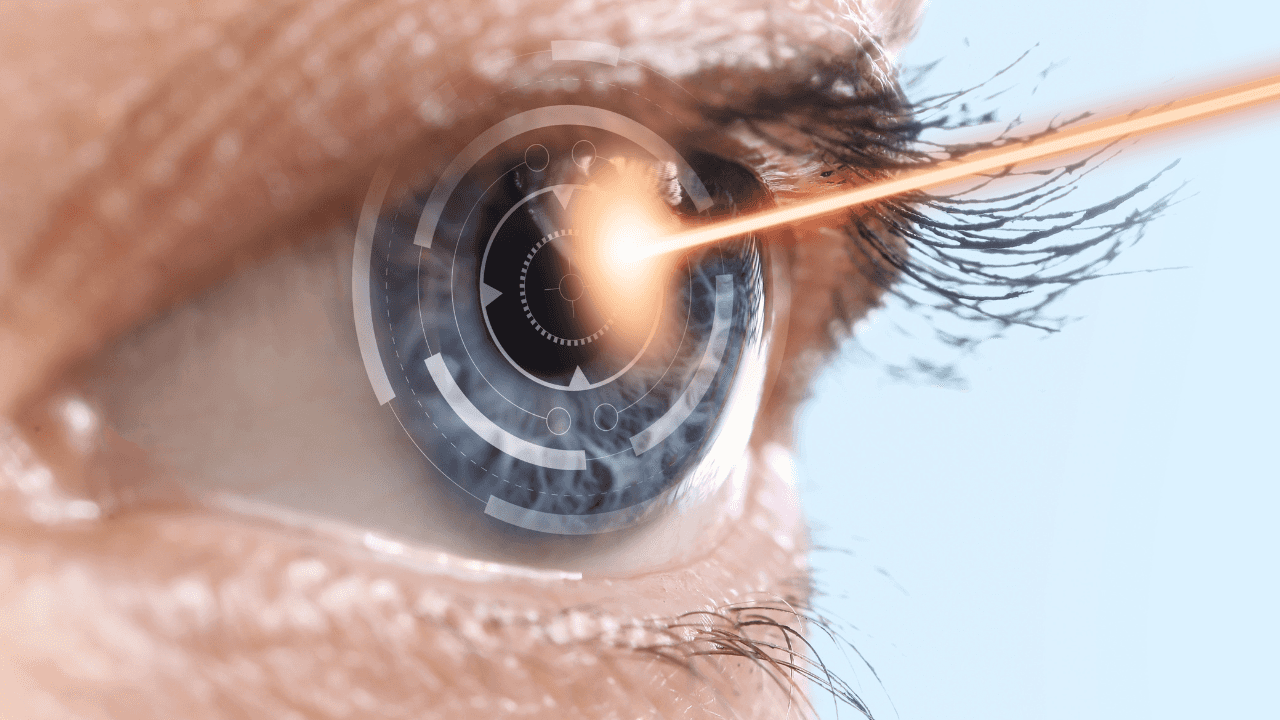 قالت أخصائية طب وجراحة العيون، الدكتورة ديمة حجاج، إن عملية الليزر تتم