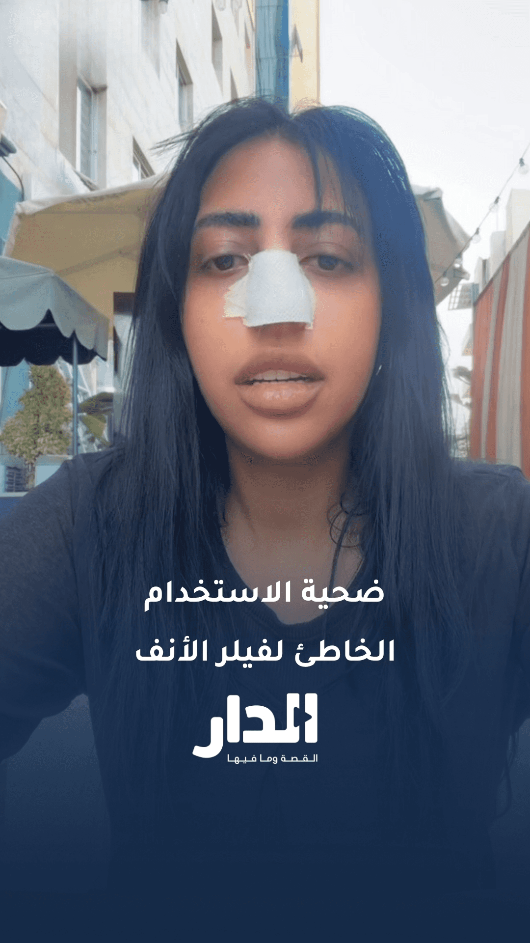 أردنية تقع ضحية استخدام فيلر الأنف بطريقة خاطئة