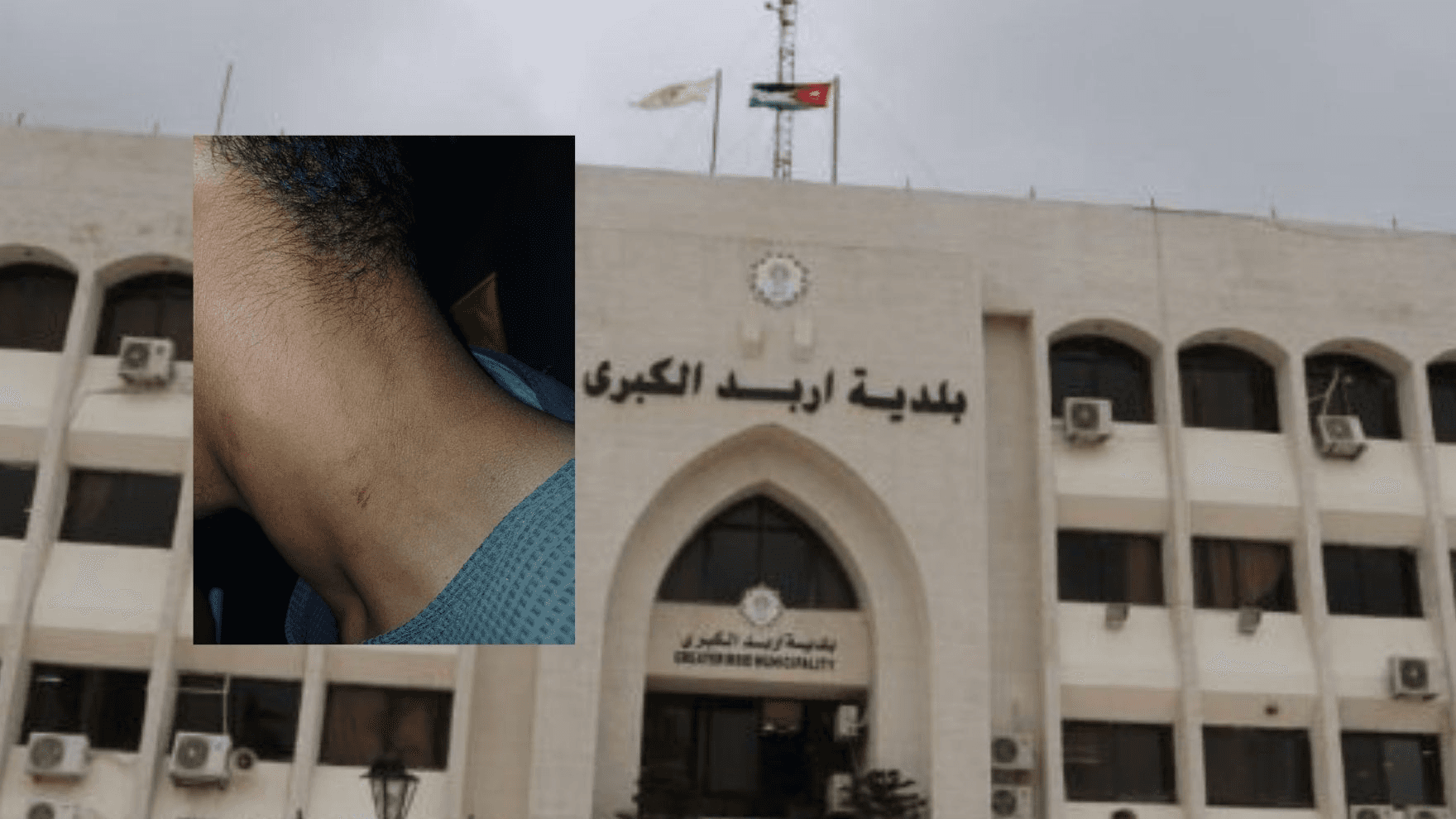 اعتداء على عامل وطن أثناء أداء واجبه في إربد والبلدية تتوعد بإجراءات قانونية
