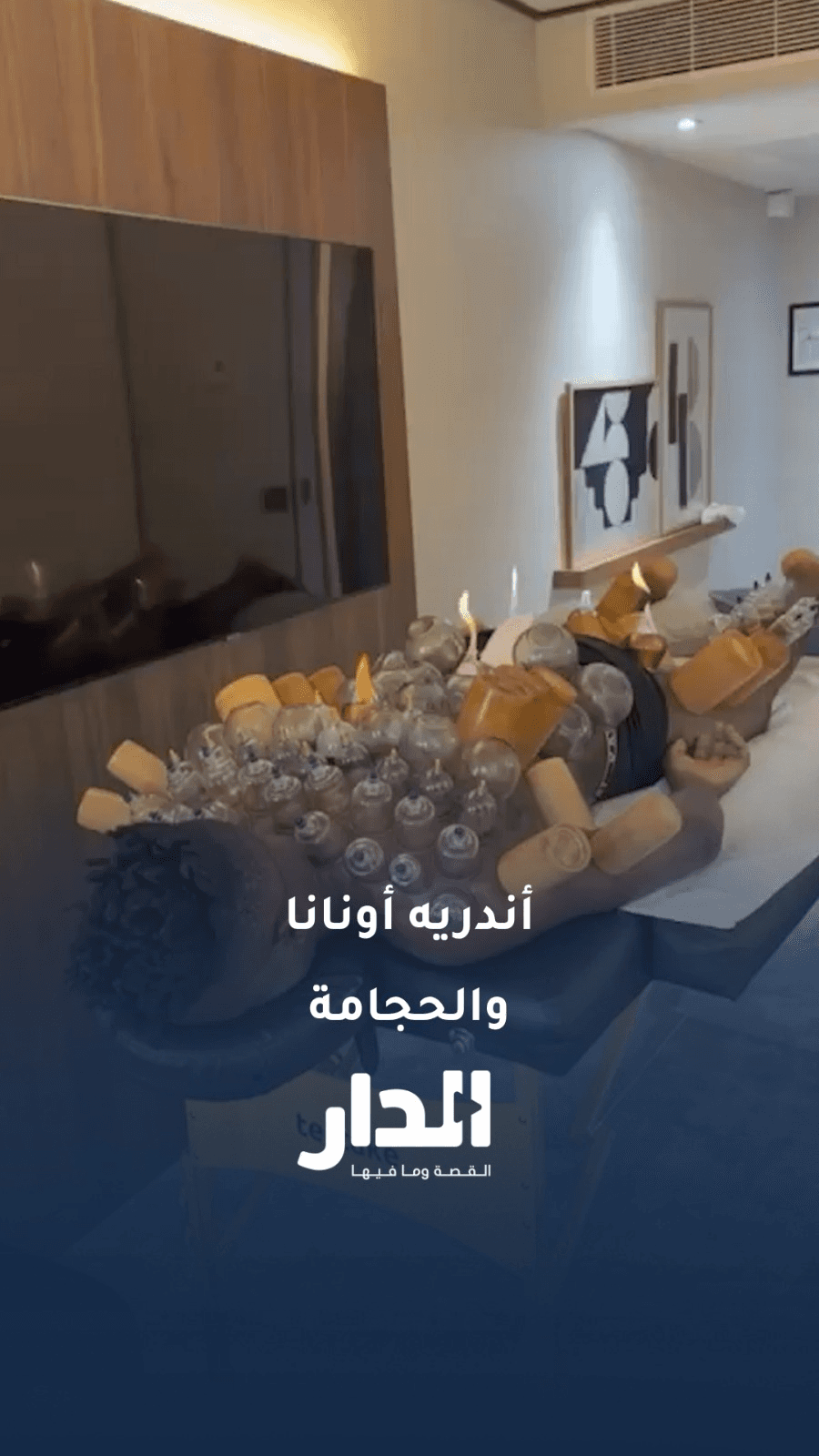 حارس نادي طرابزون سبور "أندريه أونانا" يخضع للحجامة