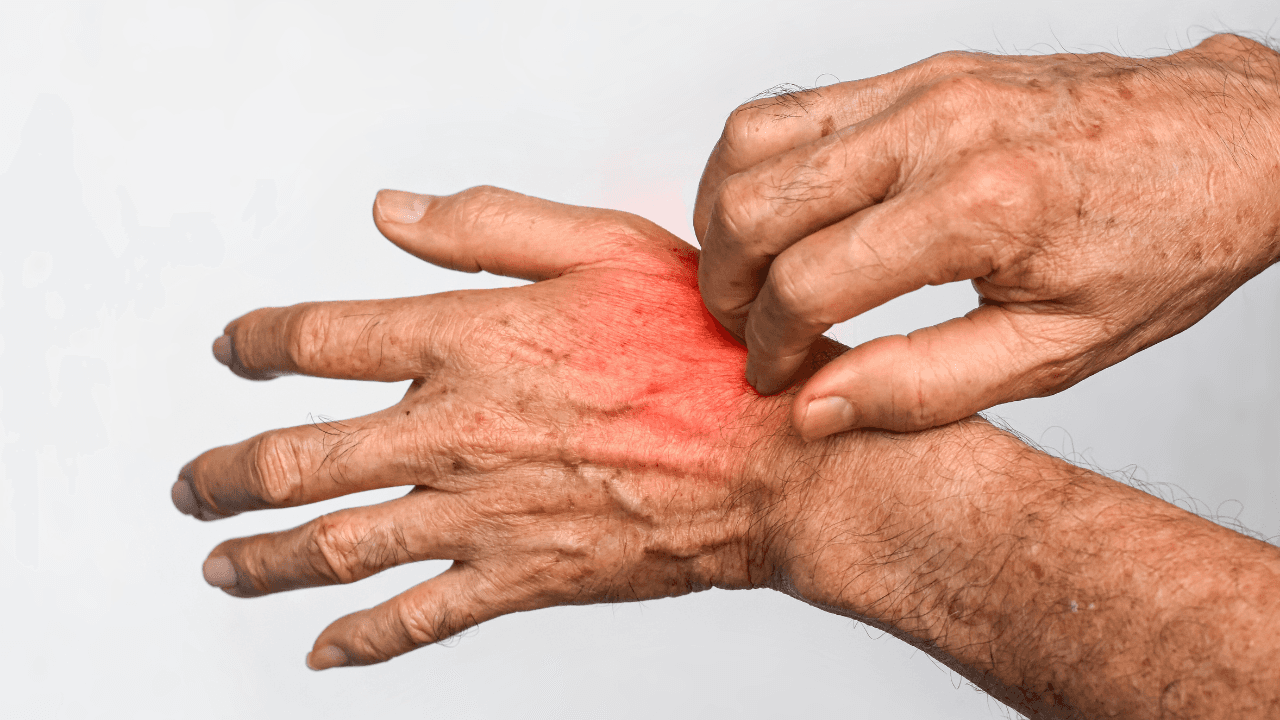 ثورة في طب الجلد.. أول علاج جيني موضعي "يصحح" الأمراض الوراثية من الجذور