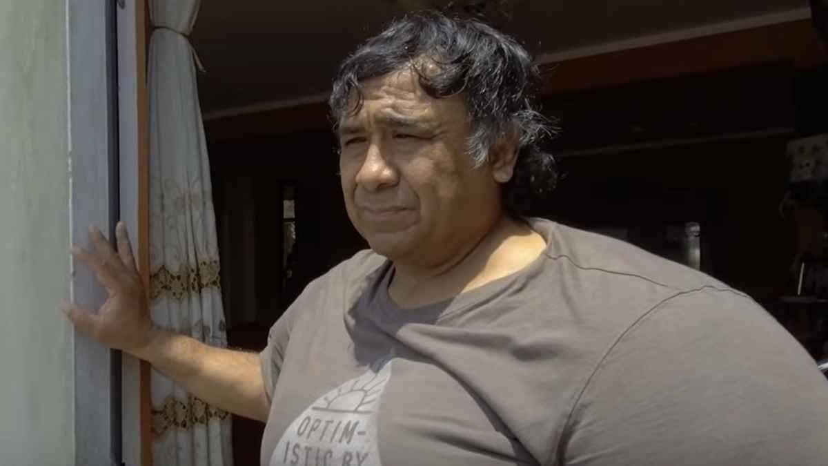 غواص يعيش 8 سنوات مع تشوهات نادرة بعد حادث مروع