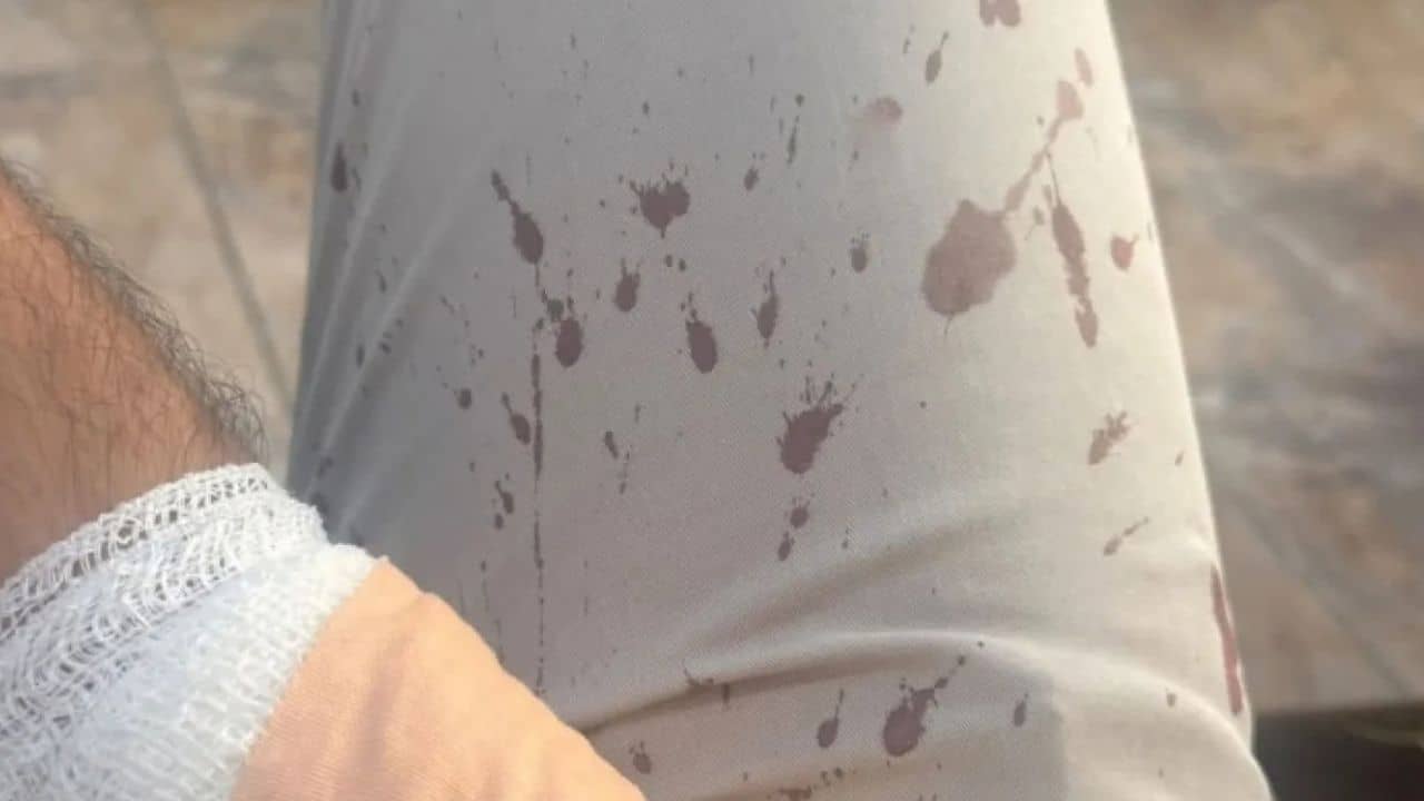 طالب يعتدي على معلم بواسطة منشار داخل مسجد