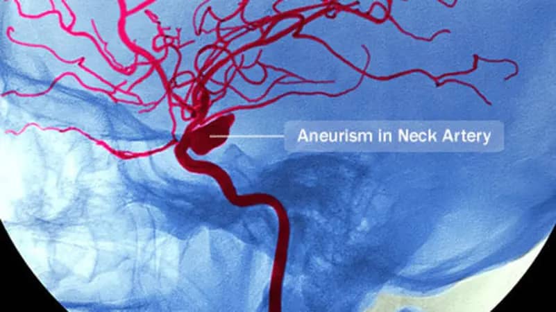 ثورة في أبحاث القلب.. أوعية دموية حية على شريحة إلكترونية