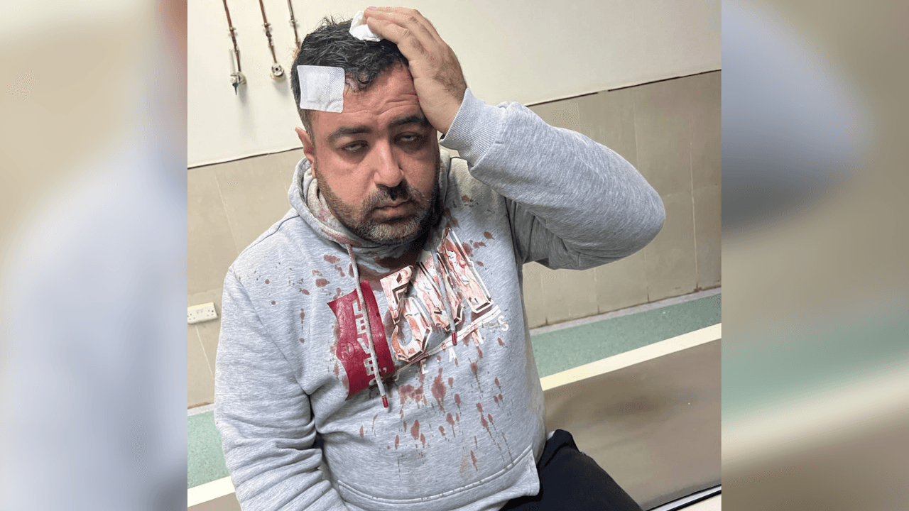 الصحفي التميمي لـ"عين": أجهل هوية المعتدين وأسباب الاعتداء