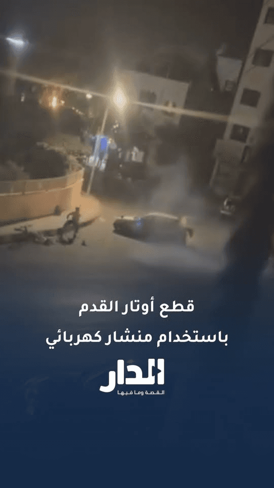 باستخدام منشار كهربائي.. الاعتداء على شخص وقطع أوتار قدمه في القويسمة