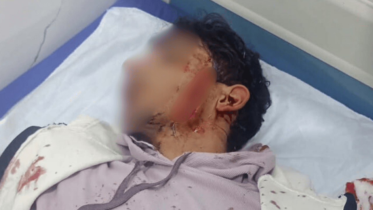 تفاصيل مروعة.. طلب منه "خاوة" وعندما رفض ضربه بوجهه بمشرط