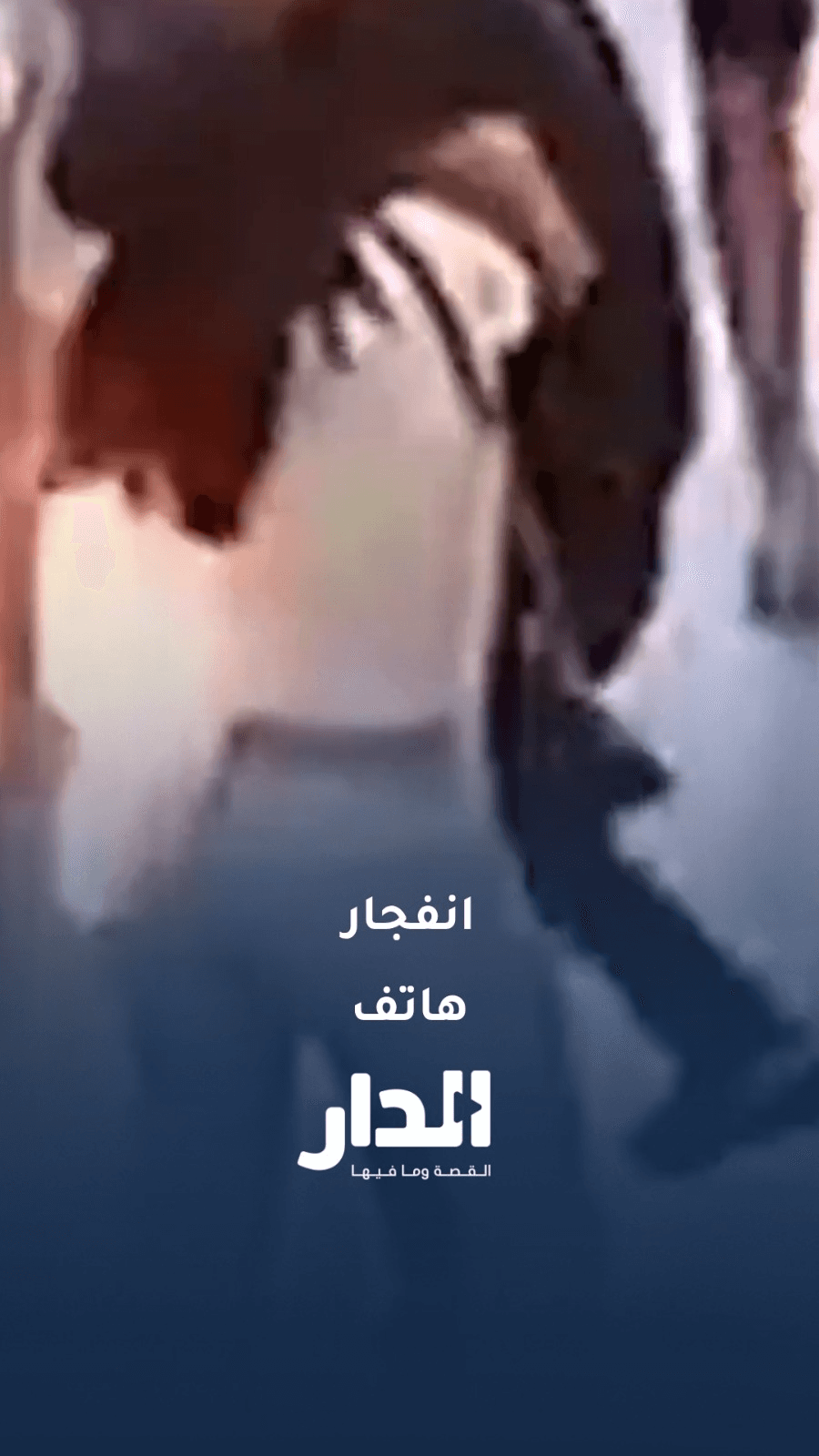 انفجار هاتف في جيب امرأة في البرازيل