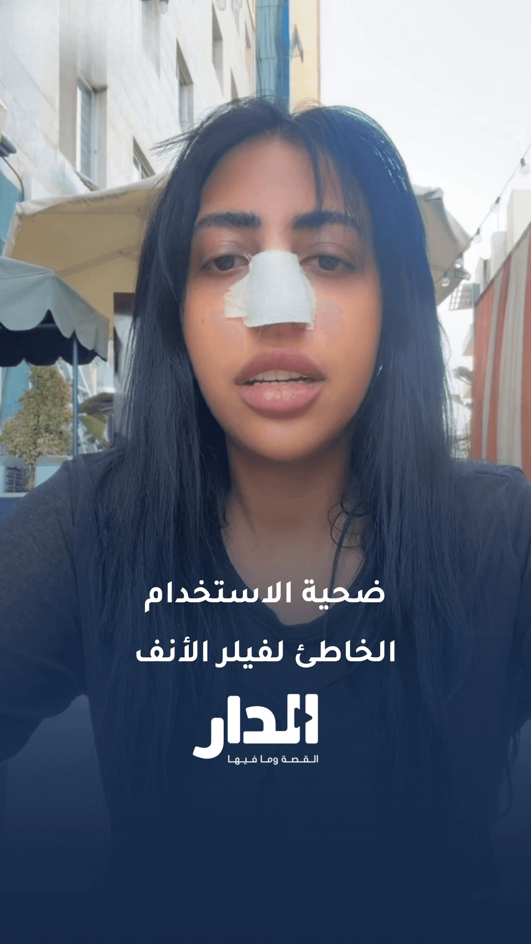أردنية تقع ضحية استخدام فيلر الأنف بطريقة خاطئة