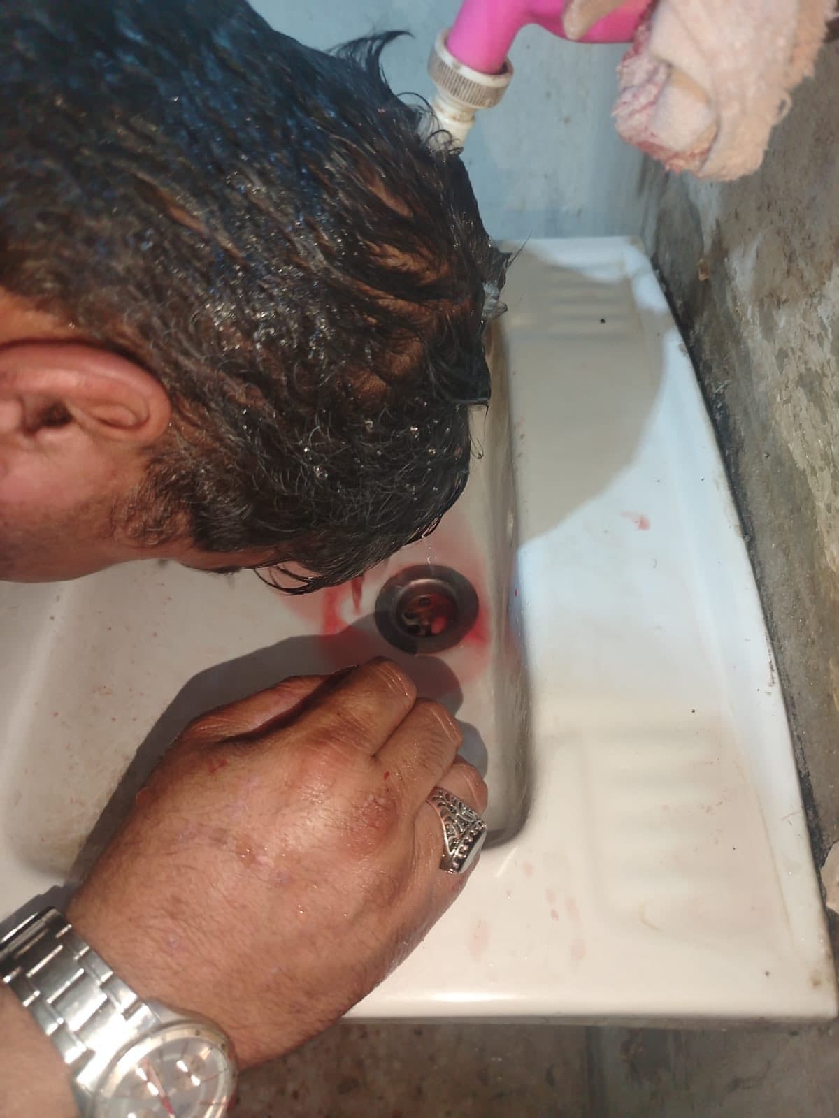إصابة مواطن بسبب شواخص مرورية.. و"بلدية إربد" توضح: ليست من اختصاصنا