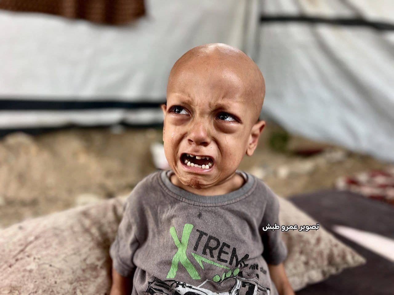 صاحب صرخة "أنا جوعان" يلتحق بقوافل الشهداء في غزة
