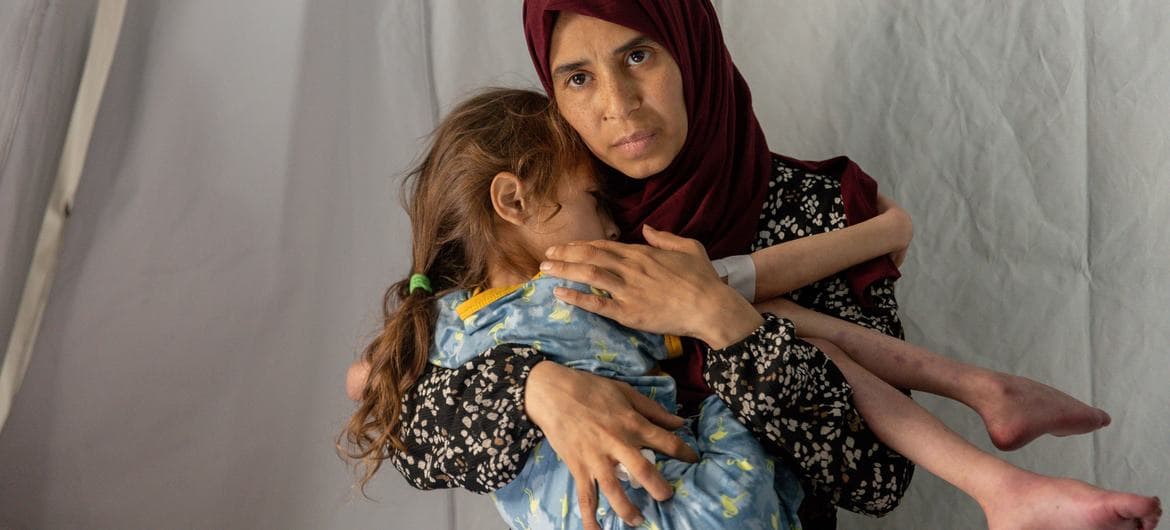 4 وفيات بينهم طفلان نتيجة المجاعة وسوء التغذية خلال الساعات الـ24 الماضية