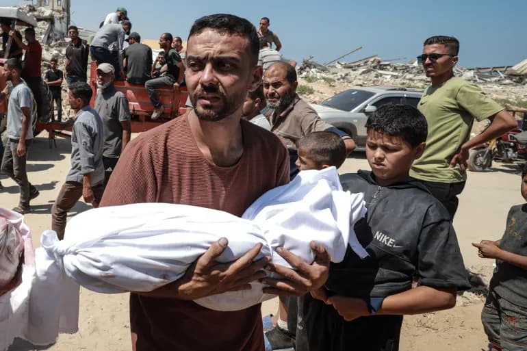 6 وفيات نتيجة المجاعة وسوء التغذية بينهم طفل خلال 24 ساعة