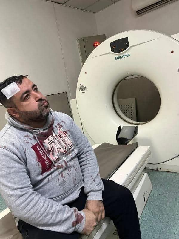 نقابة الصحفيين تتابع الاعتداء على الصحفي فيصل التميمي.. فيديو
