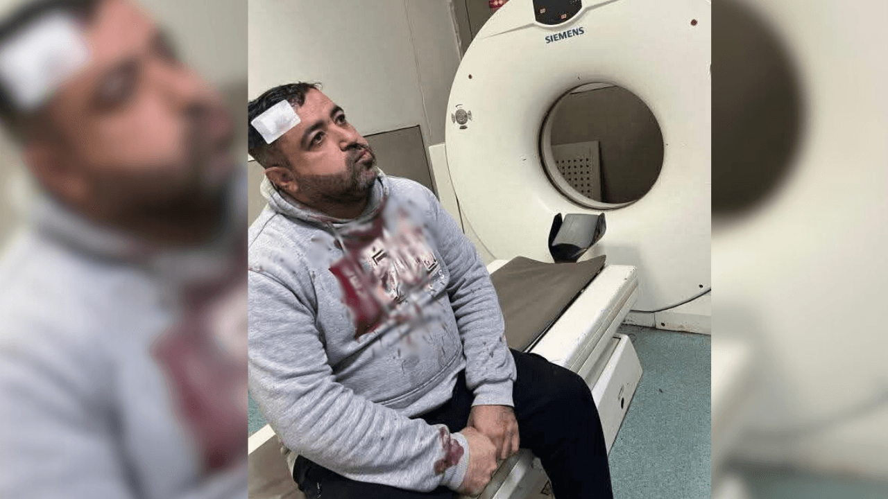 اعتداء بـ"هراوات حديدية" يستهدف الصحفي فيصل التميمي أمام منزله.. فيديو