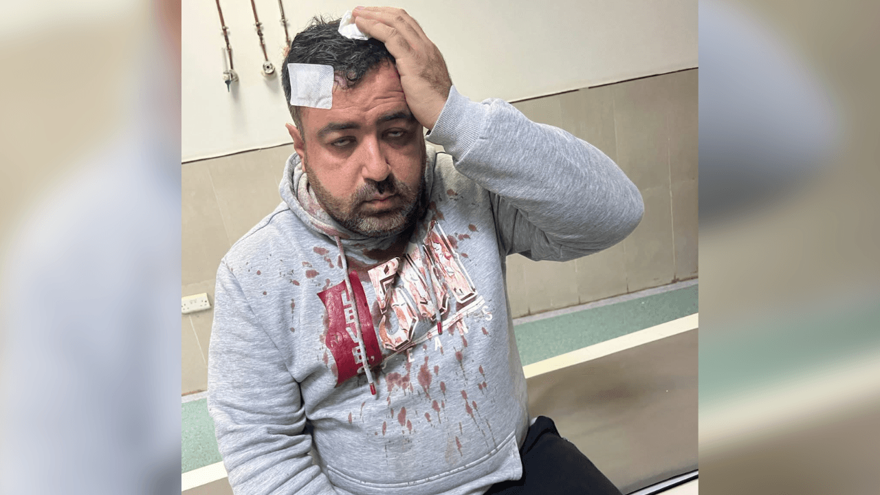 الصحفي التميمي لـ"عين": أجهل هوية المعتدين وأسباب الاعتداء