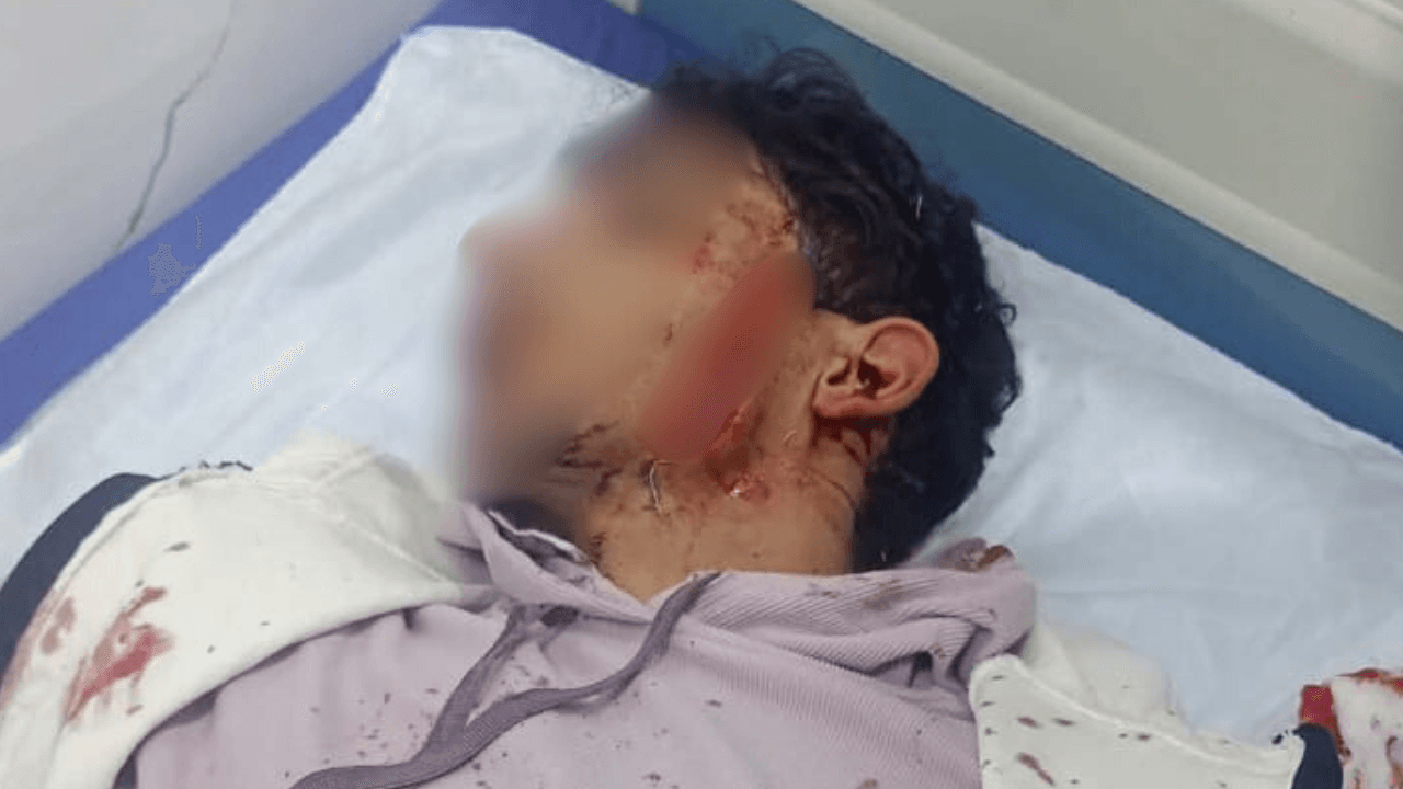 تفاصيل مرورعة.. طلب منه "خاوة" وحين لم يقبل ضربه بوجهه بمشرط