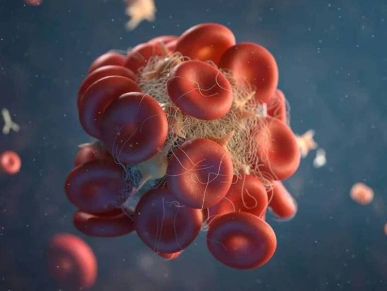 علماء صينيون يبتكرون تقنية نانوية آمنة تمنع تكوّن الجلطات الدموية