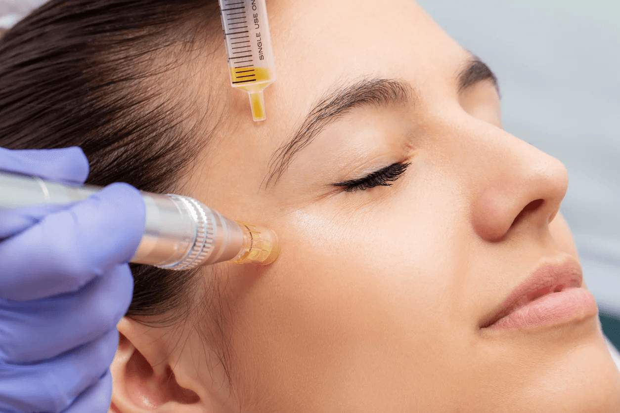 أخصائية توضح تفاصيل التجميل اللا جراحي واستخدامات البوتوكس والفيلر