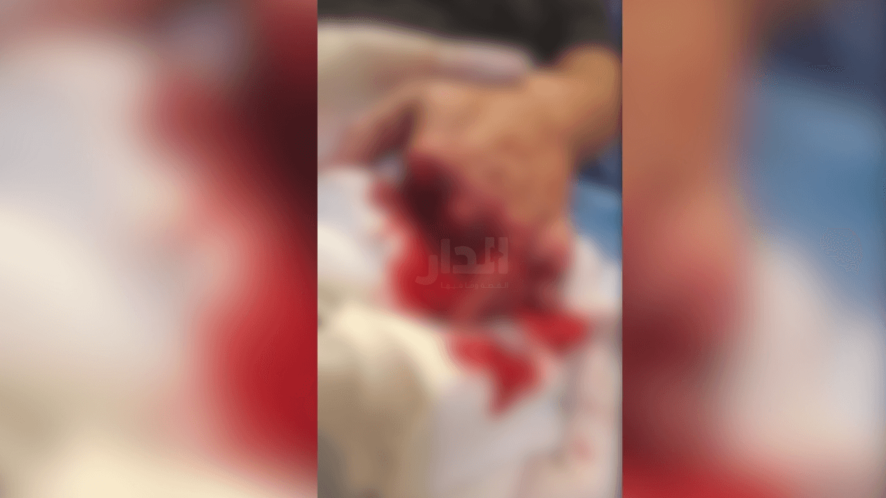 الدار - تحدث الشاب خالد عن تفاصيل تعرض شقيقه أنس للاعتداء والضرب، ما